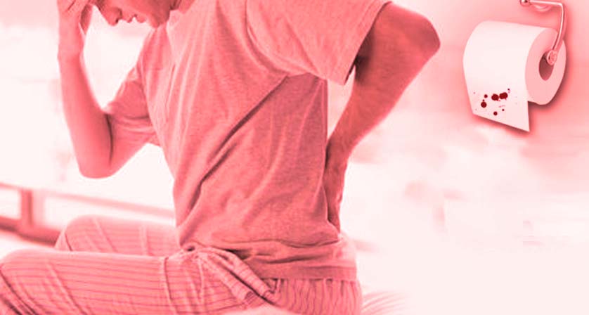 Ayurvedic Management of Piles