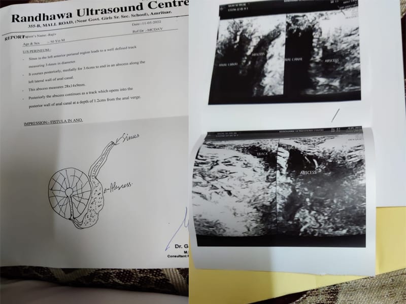 CASE STUDY: MR. RAJIV MAHAJAN