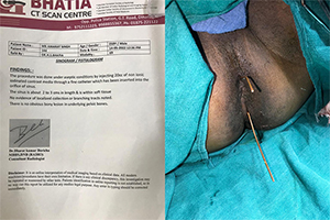 CASE STUDY: MR. AMARJIT SINGH