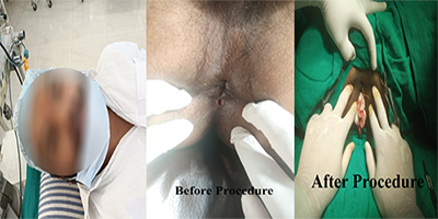 CASE STUDY: MR. VIKAS