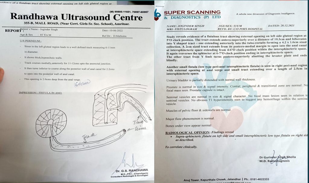 CASE STUDY: MR. JOGINDER SINGH