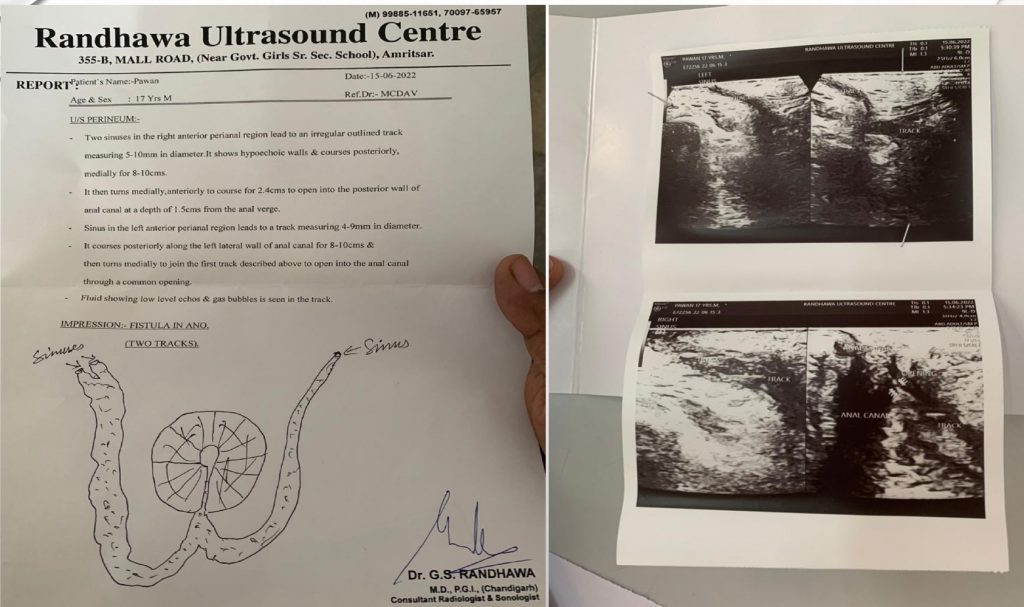 CASE STUDY: MR. PAWAN