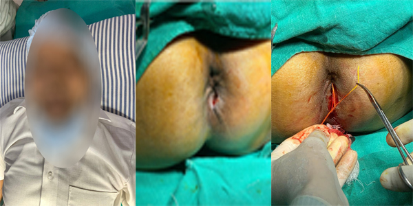 CASE STUDY: MR. SOM LAL